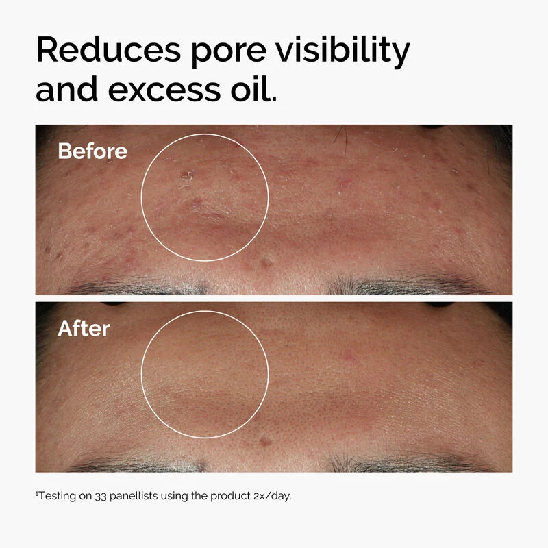 The Ordinary Niacinamide Serum 